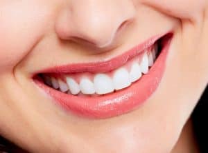 מה לעשות וממה מומלץ להימנע לאחר הלבנת שיניים