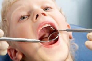 טיפולי שיניים לפעוטות לילדים ולנוער 