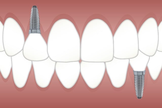 Dental implants in one day